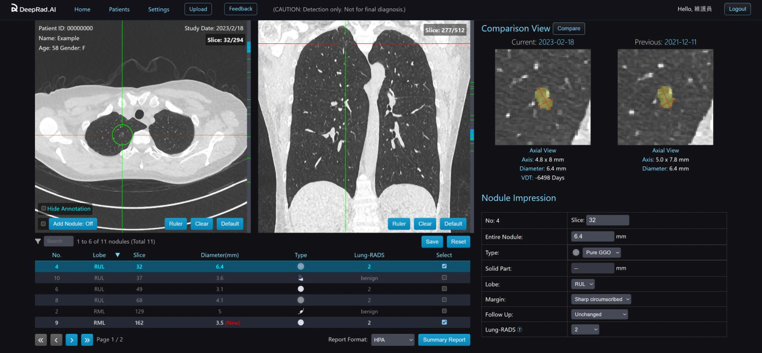 DeepLung-CAC: Multi-disease Screening Platform's photo